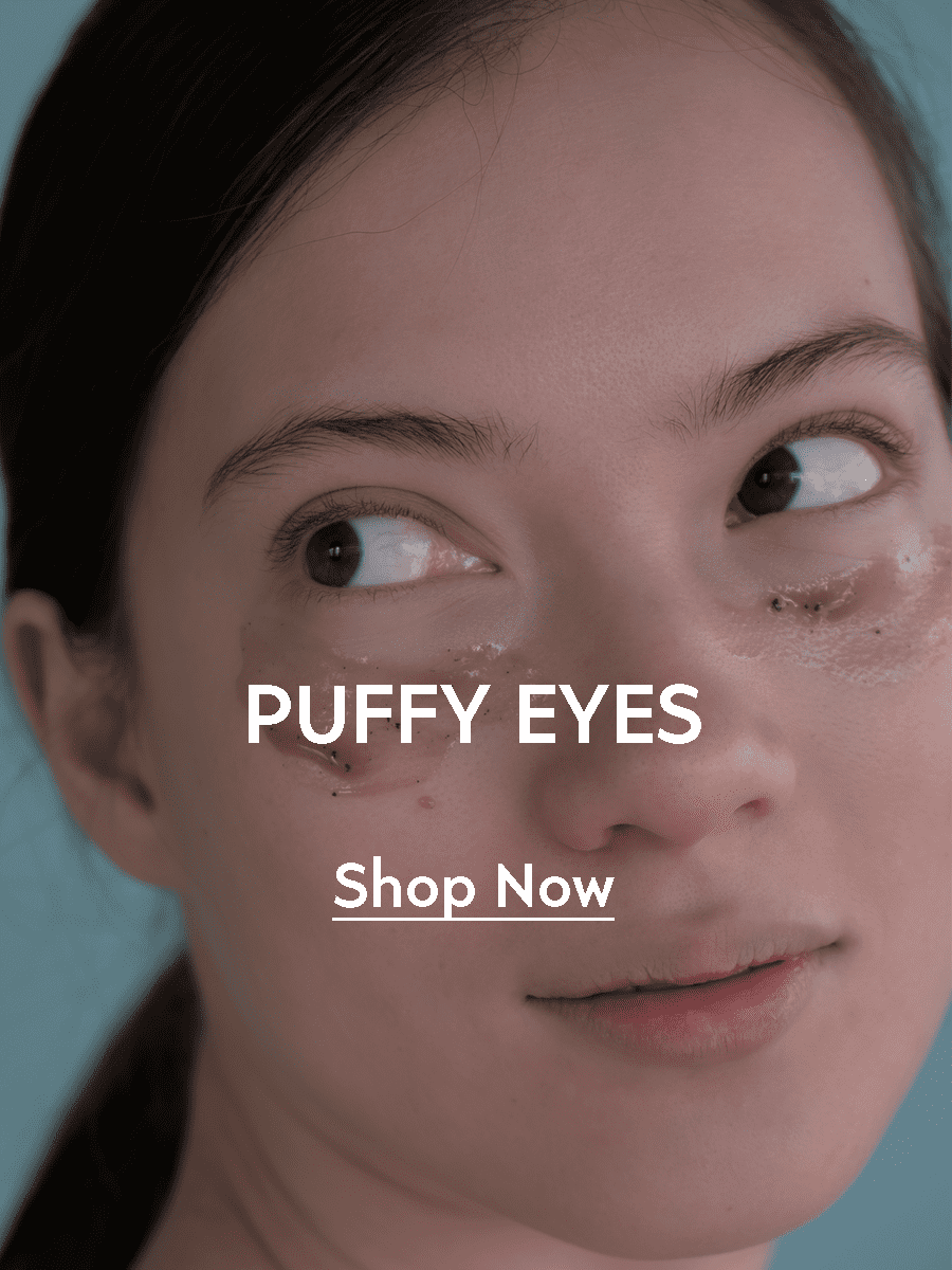 puffy_eyes